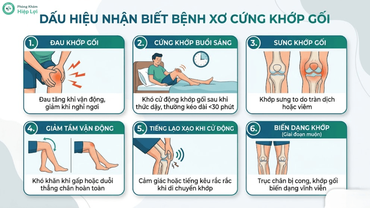 GIẢI MÃ BỆNH XƠ KHỚP: PHƯƠNG PHÁP CHẨN ĐOÁN VÀ PHỤC HỒI CHỨC NĂNG CHUẨN Y KHOA - Phòng khám Hiệp Lợi