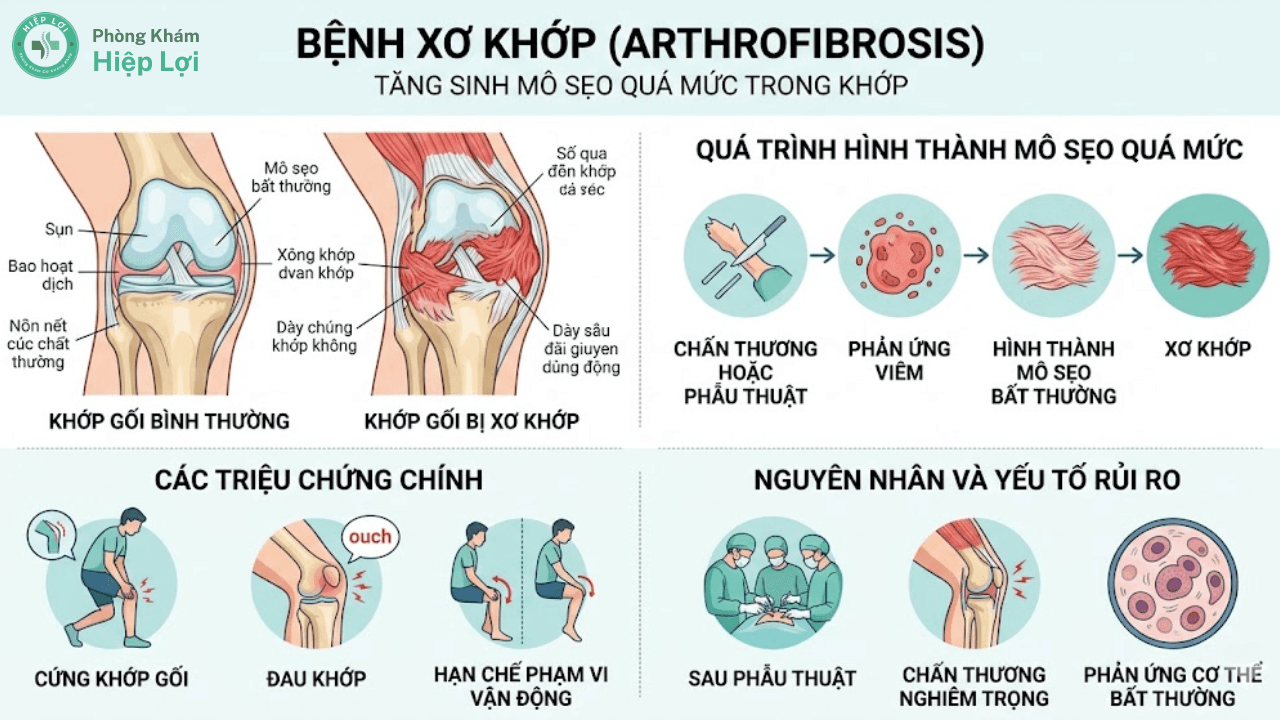 GIẢI MÃ BỆNH XƠ KHỚP: PHƯƠNG PHÁP CHẨN ĐOÁN VÀ PHỤC HỒI CHỨC NĂNG CHUẨN Y KHOA