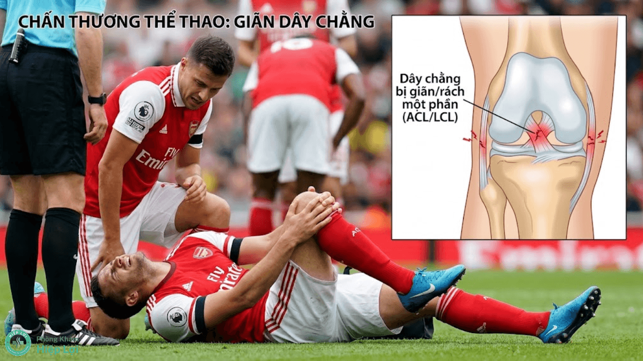 Giãn Dây Chằng Vai: Nguyên Nhân, Triệu Chứng Và Cách Xử Lý - Phòng khám Hiệp Lợi
