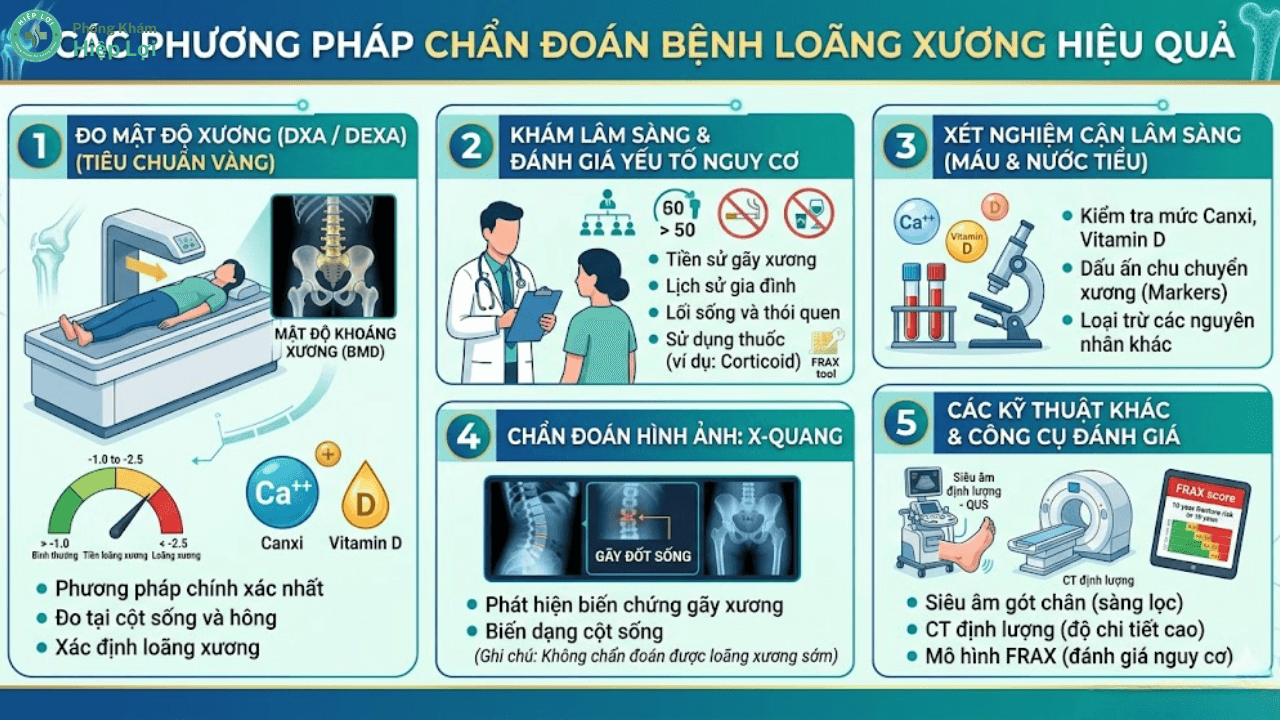 Tổng Quan Các Phương Pháp Chẩn Đoán Bệnh Loãng Xương