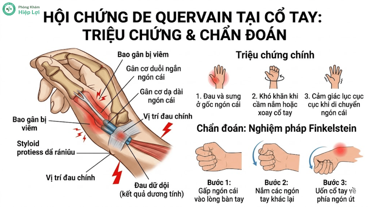Viêm Bao Gân Cổ Tay: Nguyên Nhân, Dấu Hiệu Và Cách Điều Trị - Phòng khám Hiệp Lợi