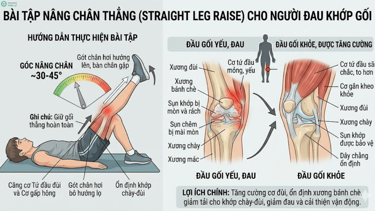 Hướng Dẫn Các Bài Tập Thể Dục Cho Người Đau Khớp Gối An Toàn Và Hiệu Quả Nhất - Phòng khám Hiệp Lợi